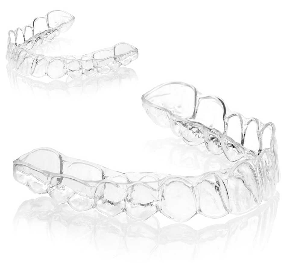 clear aligner info